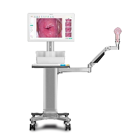 Colposcope